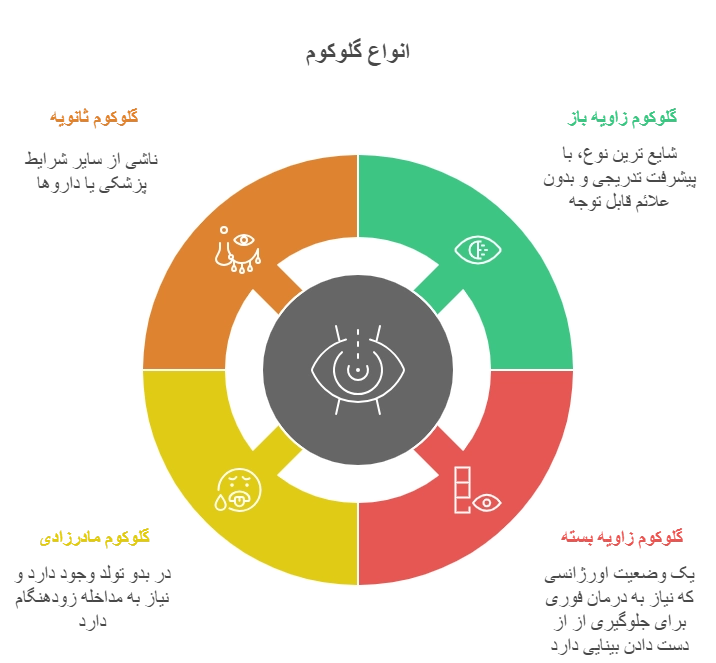 انواع گلوکوم