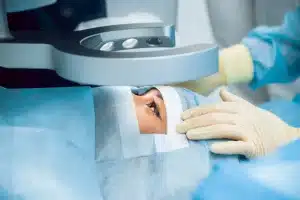 ۱۰ نکته مهم درباره عمل لیزیک چشم در سال ۱۴۰۴