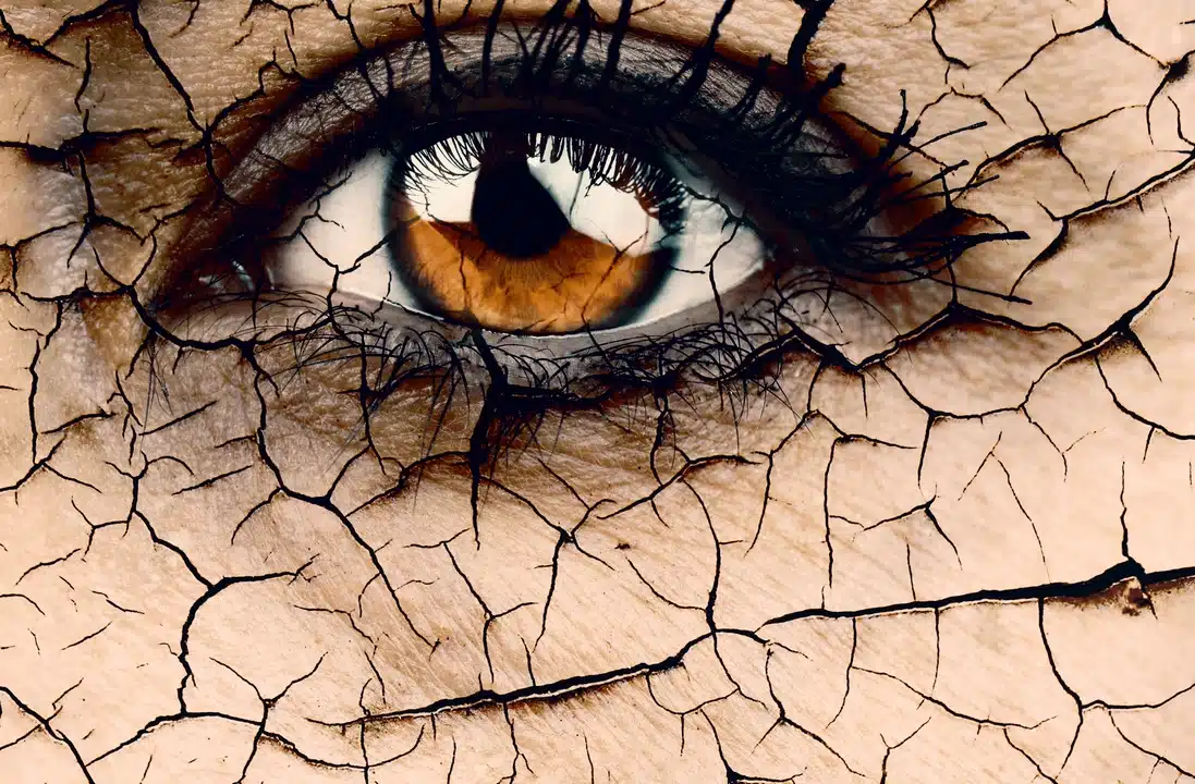 چرا خشکی چشم را جدی بگیریم؟