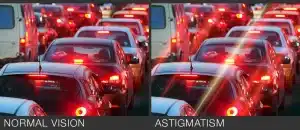 خداحافظی با تاری دید و سردرد! درمان آستیگماتیسم