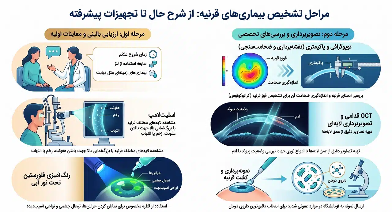 پزشک چگونه بیماری های قرنیه را تشخیص می دهد؟