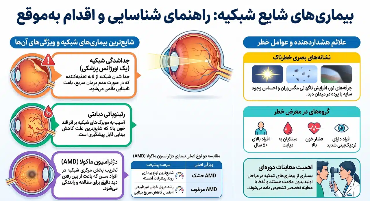 مهمترین بیماریهای شبکیه چشم کداماند؟