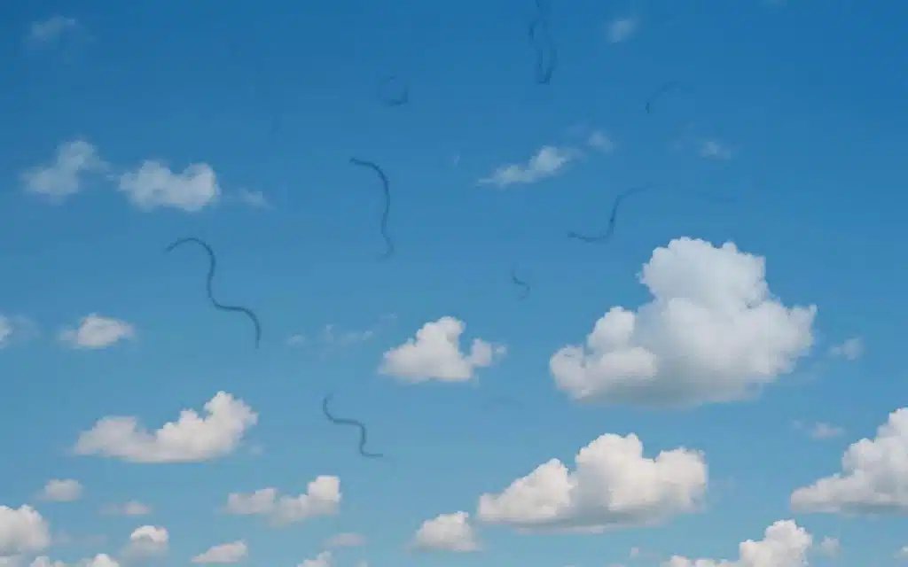 مگس پران چشم (Floaters)