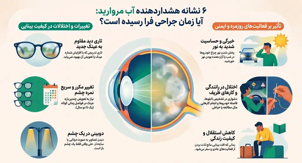 ۷ نشانهای که نشان میدهد احتمالاً زمان عمل آب مروارید رسیده است