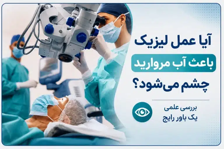 آیا عمل لیزیک باعث آب مروارید چشم می‌شود؟ بررسی علمی یک باور رایج