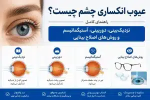 عیوب انکساری چشم چیست؟ راهنمای کامل نزدیک‌بینی، دوربینی، آستیگماتیسم و روش‌های اصلاح بینایی