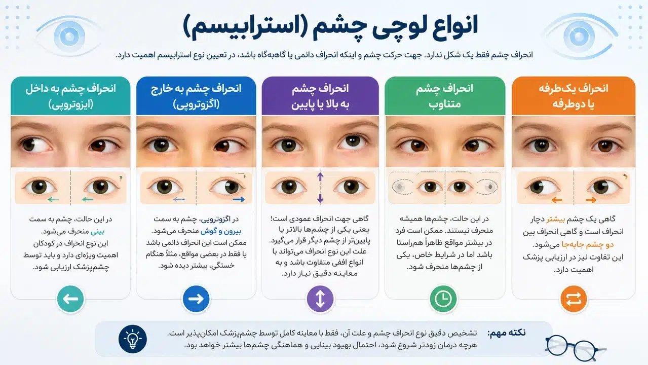 انواع لوچی چشم
