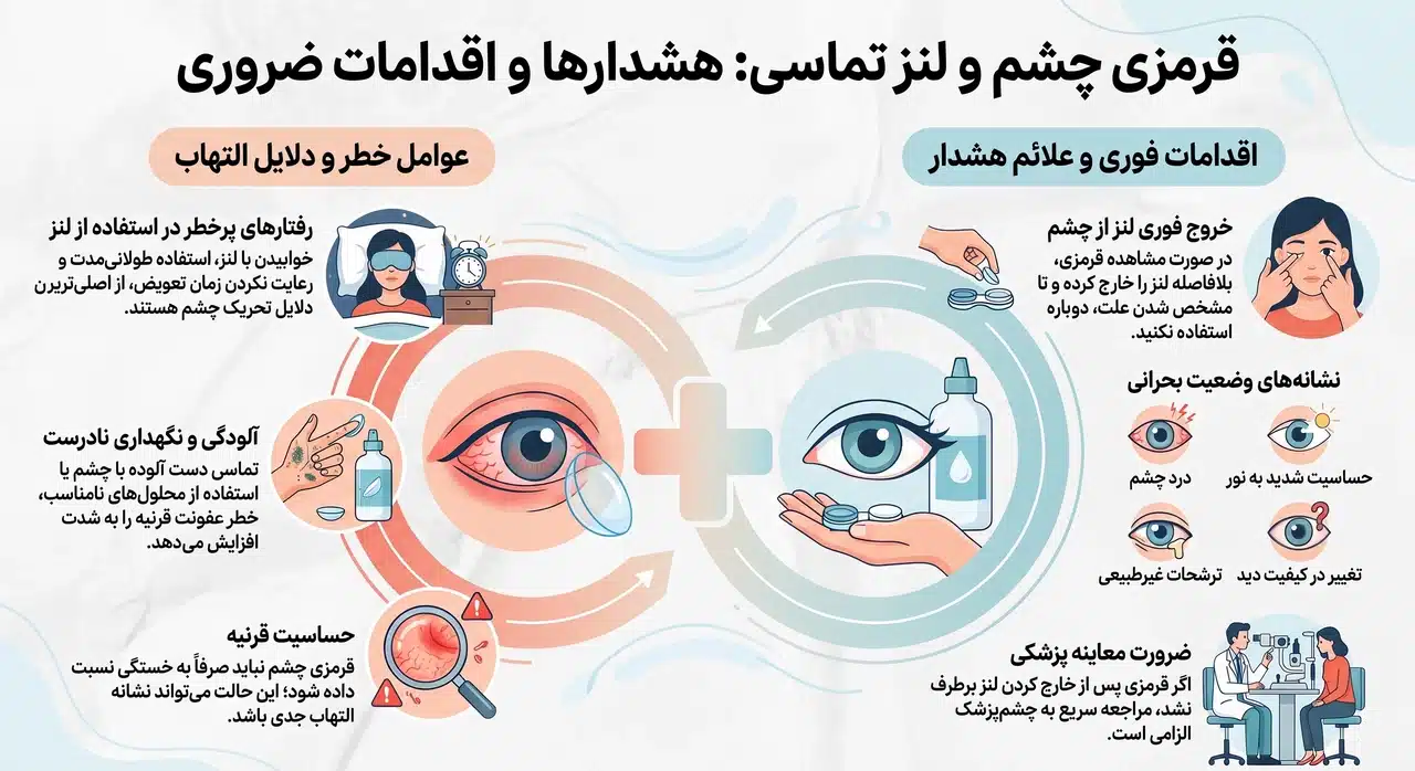 قرمزی چشم و لنز تماسی