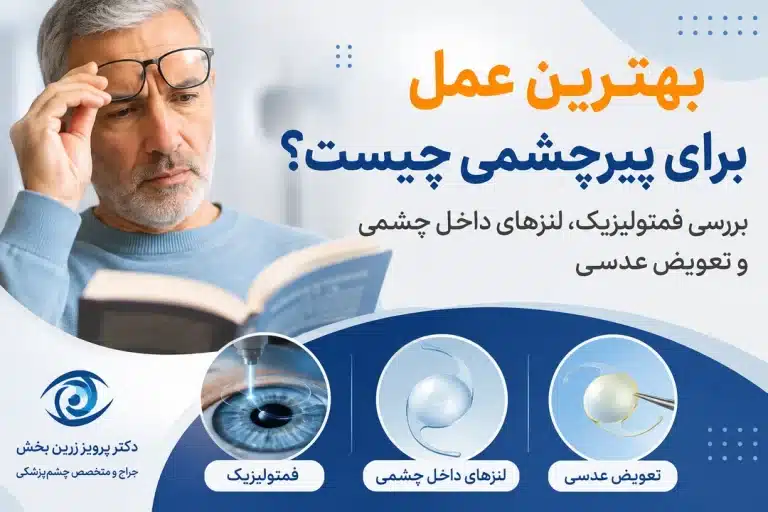 بهترین عمل برای پیرچشمی چیست؟ بررسی فمتولیزیک، لنزهای داخل چشمی و تعویض عدسی