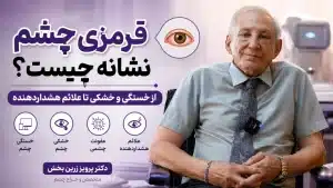 قرمزی چشم نشانه چیست؟ از خستگی و خشکی تا علائم هشداردهنده