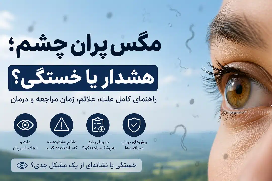 مگس پران چشم؛ هشدار یا خستگی؟