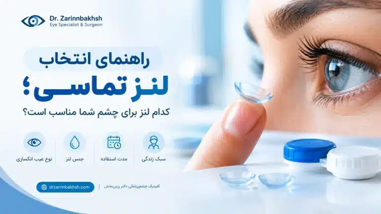 راهنمای انتخاب لنز تماسی؛ کدام لنز برای چشم شما مناسب است؟