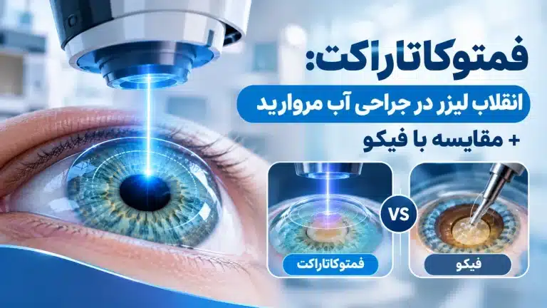 فمتوکاتاراکت انقلاب لیزر در جراحی آب مروارید + مقایسه با فیکو