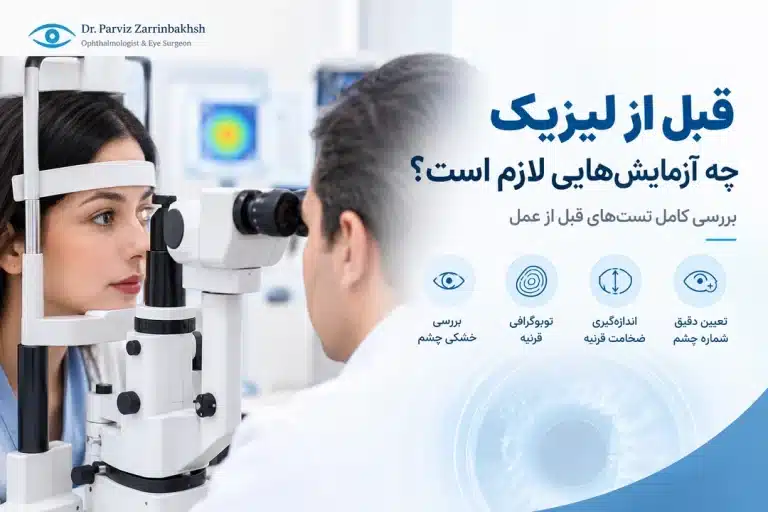 قبل از لیزیک چه آزمایش‌هایی لازم است؟