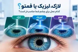 لازک، لیزیک یا فمتو؟ کدام عمل برای چشم شما مناسب‌تر است؟